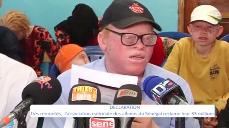 Le président de l’association nationale des albinos détourne 33 millions F CFA